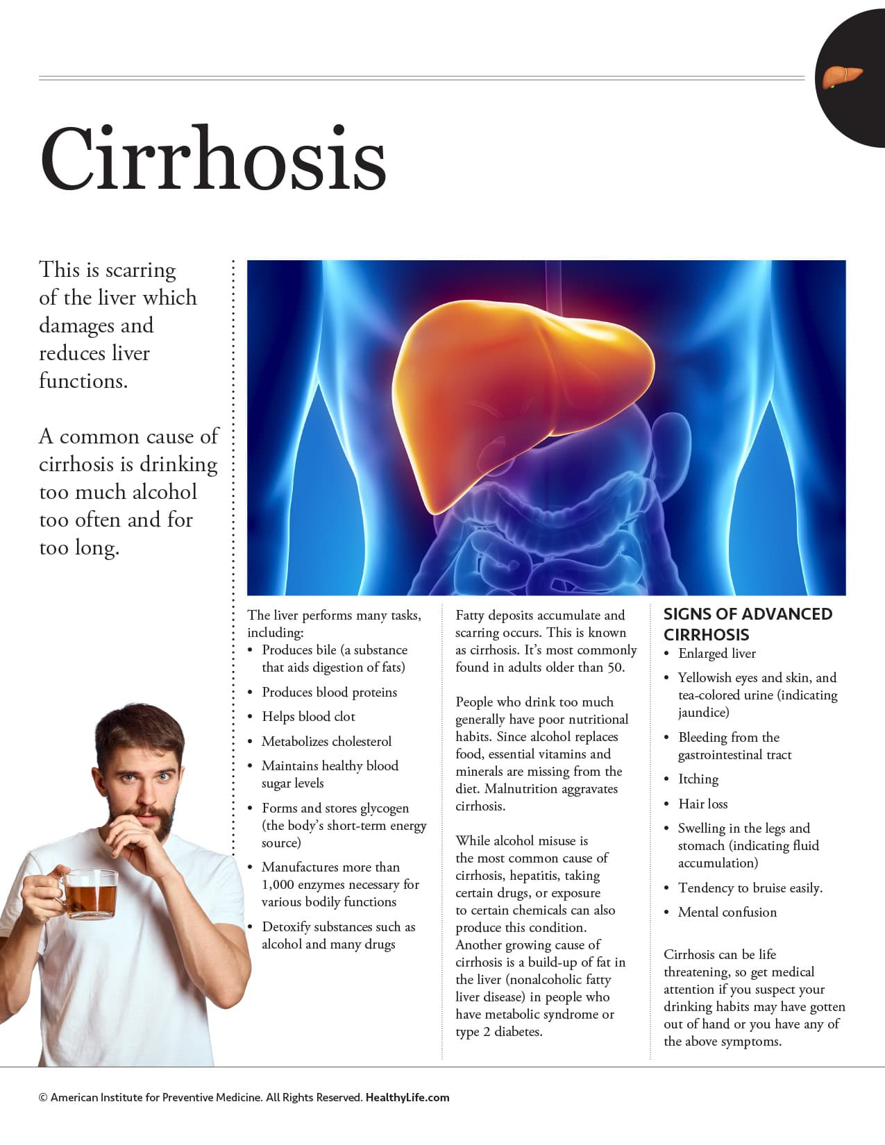 aipm_hh_cirrhosis