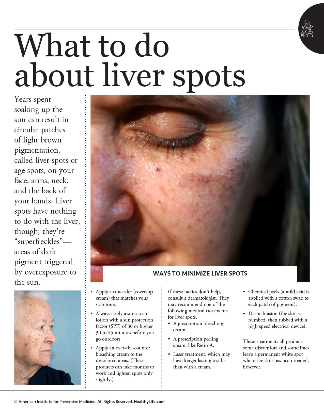 aipm_hh_liver-spots